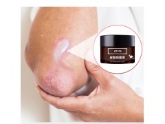 皮肤抑菌膏代加工厂家 贴牌定制图3