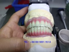 数字化种植牙出口工厂（整合CAD/CAM系统与3D打印技术）图1