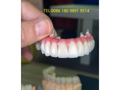 全口假牙数字化切削加工厂，厂家直销源头价，省去中间商利润图2